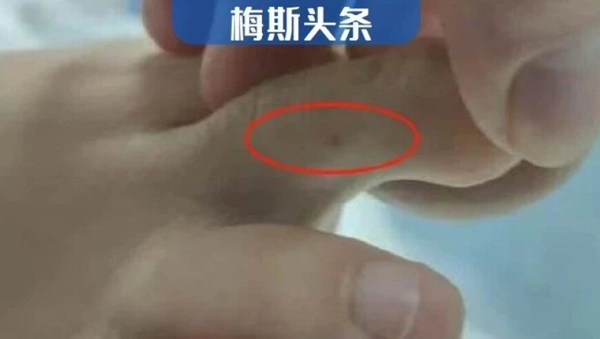 老澳门开奖结果2025开奖记录查询官网,库里受伤离场,精准解释落实及其象征意义_枚举版V5.42